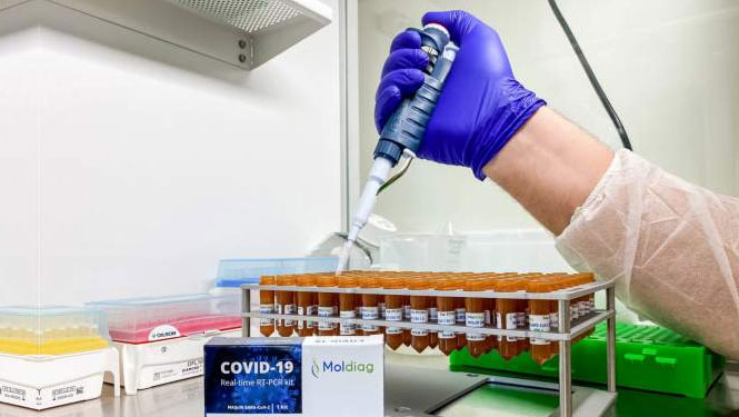 Covid-19: das 100% marokkanische Diagnostik-Kit verfügbar